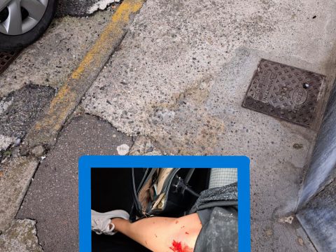 Marciapiedi e strade colabrodo, cade una donna e si ferisce, proteste sui social