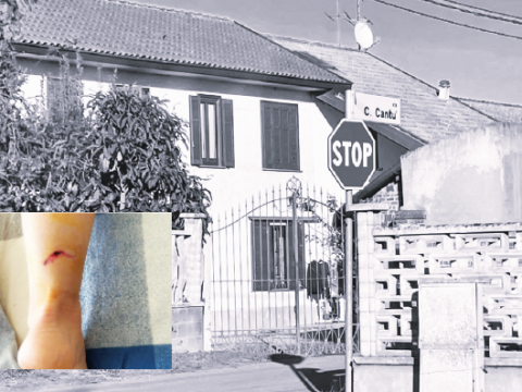 Aggredita da un cane davanti alla sua abitazione