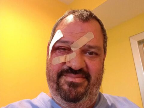 Aggredito al Beato Matteo mentre cerca di riportare la calma, carabiniere in pensione preso a pugni e bastonate. Cassese: «Inaccettabile che un gesto di altruismo si trasformi in un’aggressione»